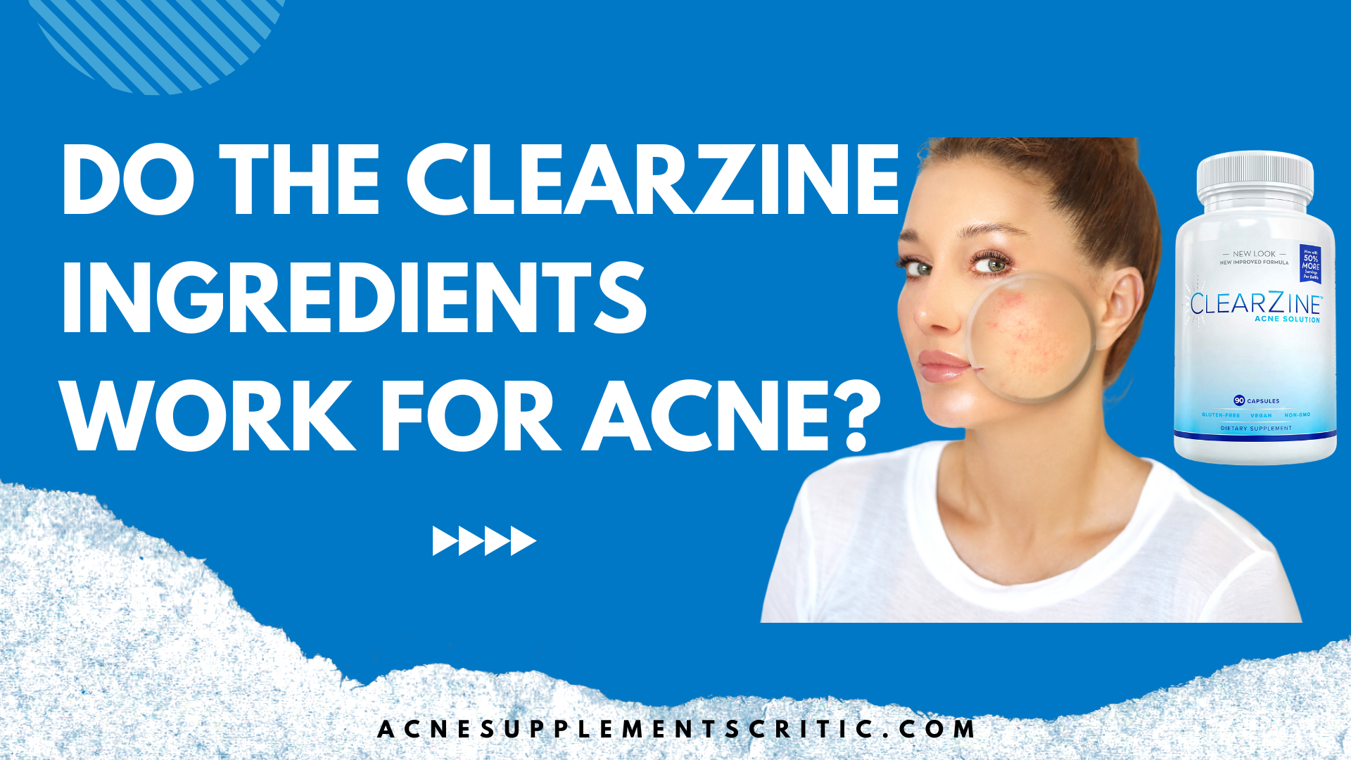 clearzine acne ingredients