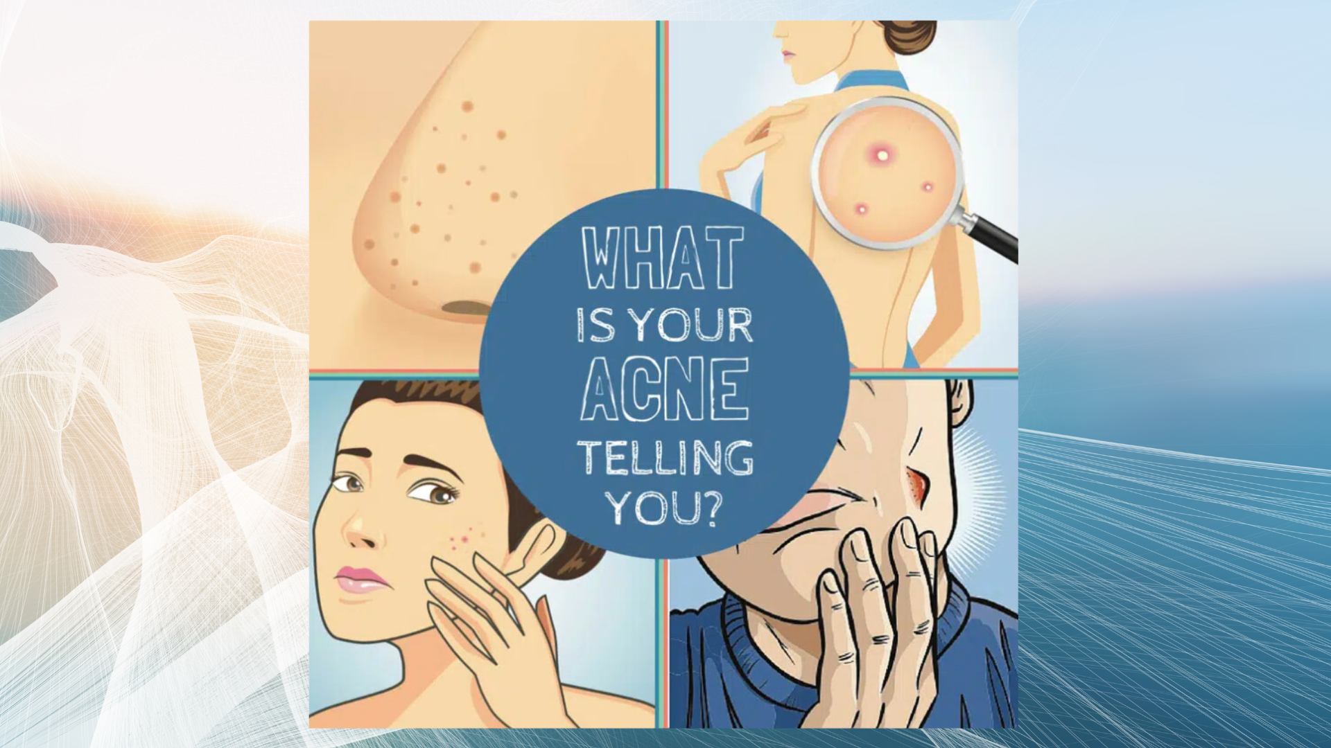 what does acne reveal about your health