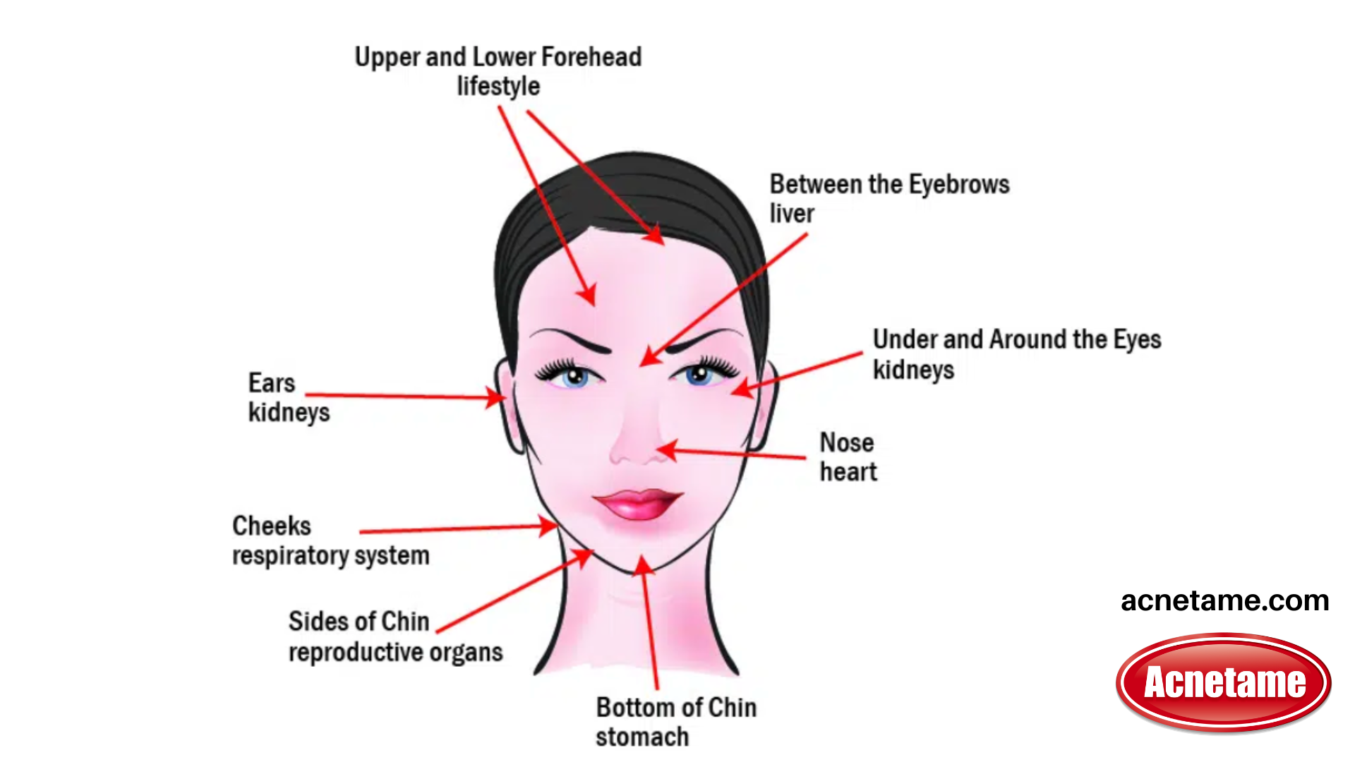 acne face map